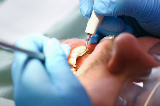 Best Emergency Broken Tooth Repair in Wliamsvle, IL