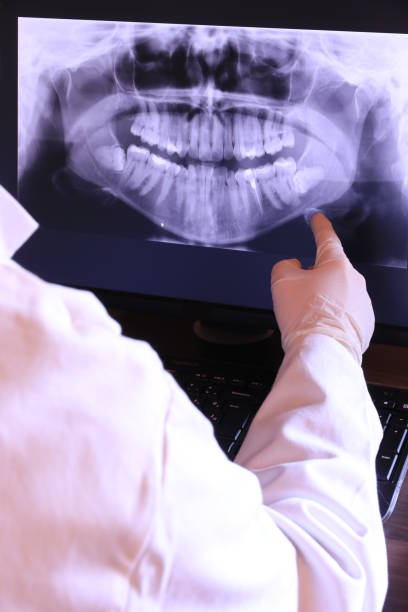 Best Emergency Treatment for Toothache in Wliamsvle, IL