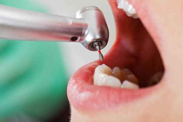 Best Emergency Dental Care for Trauma or Injury in Wliamsvle, IL